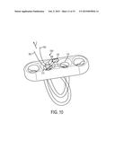 ADJUSTABLE GRAFT FIXATION DEVICE diagram and image