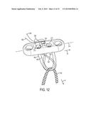 ADJUSTABLE GRAFT FIXATION DEVICE diagram and image