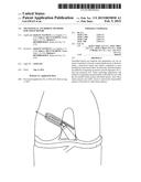 TRANSOSTEAL ANCHORING METHODS FOR TISSUE REPAIR diagram and image