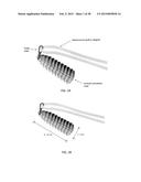 TRANSOSTEAL ANCHORING METHODS FOR TISSUE REPAIR diagram and image