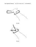 TRANSOSTEAL ANCHORING METHODS FOR TISSUE REPAIR diagram and image