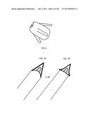 TRANSOSTEAL ANCHORING METHODS FOR TISSUE REPAIR diagram and image