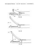 TRANSOSTEAL ANCHORING METHODS FOR TISSUE REPAIR diagram and image