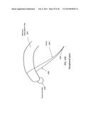 TRANSOSTEAL ANCHORING METHODS FOR TISSUE REPAIR diagram and image