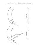 TRANSOSTEAL ANCHORING METHODS FOR TISSUE REPAIR diagram and image