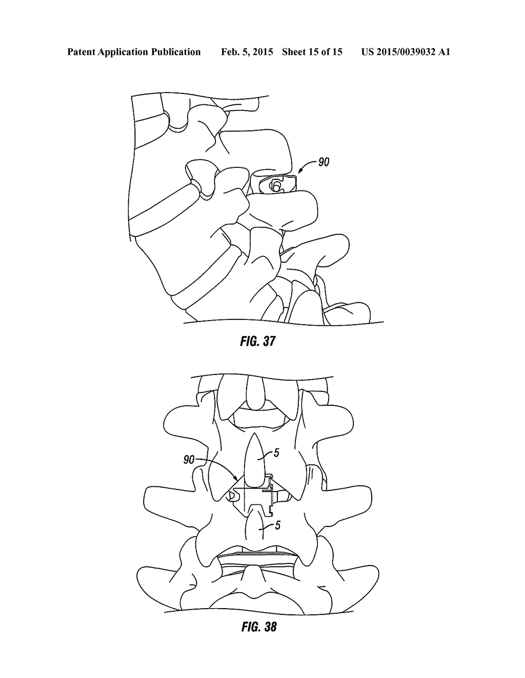 Lateral Spinous Process Spacer - diagram, schematic, and image 16