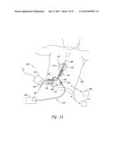 PHYSICIAN PROGRAMMER WITH ENHANCED GRAPHICAL USER INTERFACE, AND     ASSOCIATED SYSTEMS AND METHODS diagram and image