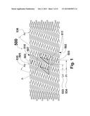 FLEXIBLE STENT diagram and image