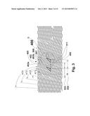 FLEXIBLE STENT diagram and image