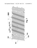 FLEXIBLE STENT diagram and image