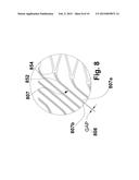 FLEXIBLE STENT diagram and image