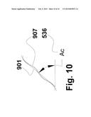 FLEXIBLE STENT diagram and image