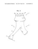 VASCULAR PROSTHESIS FOR TREATING ANEURYSMS diagram and image