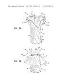 VASCULAR PROSTHESIS FOR TREATING ANEURYSMS diagram and image