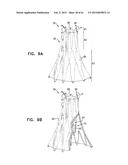 VASCULAR PROSTHESIS FOR TREATING ANEURYSMS diagram and image