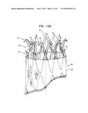 VASCULAR PROSTHESIS FOR TREATING ANEURYSMS diagram and image