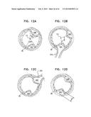 VASCULAR PROSTHESIS FOR TREATING ANEURYSMS diagram and image