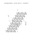 VARIABLE STIFFNESS STENT diagram and image