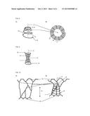 IMPLANT FOR BUNDLING A PLURALITY OF TENDONS, PARTICULARLY CHORDAE     TENDINEAE diagram and image