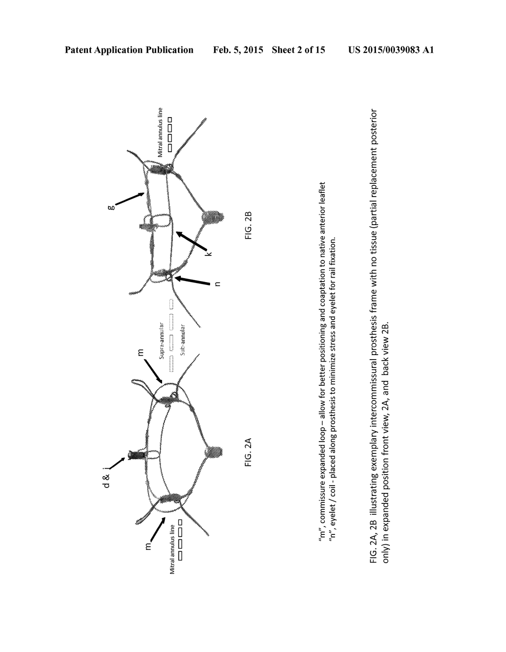 DEVICES, SYSTEMS AND METHODS FOR REPAIRING LUMENAL SYSTEMS - diagram, schematic, and image 03