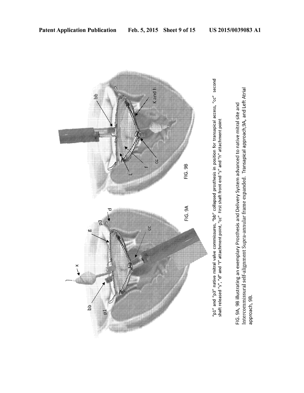 DEVICES, SYSTEMS AND METHODS FOR REPAIRING LUMENAL SYSTEMS - diagram, schematic, and image 10