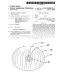 MUCOSAL CAPTURE FIXATION OF MEDICAL DEVICE diagram and image