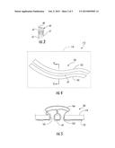 MUCOSAL CAPTURE FIXATION OF MEDICAL DEVICE diagram and image