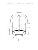 Tuck In Top Device diagram and image