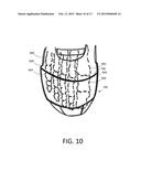 TOE PROTECTOR FOR ATHLETIC FOOTWEAR HAVING REMOVABLE CLEATS diagram and image