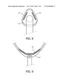 PATIENT INTERFACE HAVING ILLUMINATED PORTION diagram and image