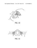 PATIENT INTERFACE HAVING ILLUMINATED PORTION diagram and image