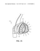 PATIENT INTERFACE HAVING ILLUMINATED PORTION diagram and image