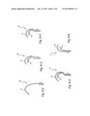 CUSHION AND CUSHION TO FRAME ASSEMBLY MECHANISM FOR PATIENT INTERFACE diagram and image