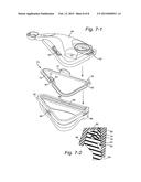 CUSHION AND CUSHION TO FRAME ASSEMBLY MECHANISM FOR PATIENT INTERFACE diagram and image