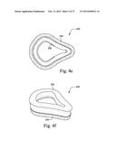 FOAM-BASED INTERFACING STRUCTURE diagram and image