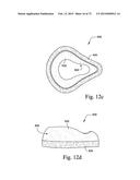 FOAM-BASED INTERFACING STRUCTURE diagram and image