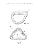 FOAM-BASED INTERFACING STRUCTURE diagram and image