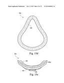 FOAM-BASED INTERFACING STRUCTURE diagram and image