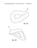 FOAM-BASED INTERFACING STRUCTURE diagram and image