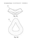 FOAM-BASED INTERFACING STRUCTURE diagram and image