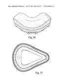 FOAM-BASED INTERFACING STRUCTURE diagram and image