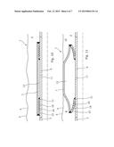 ANNULAR BARRIER HAVING A FLEXIBLE CONNECTION diagram and image