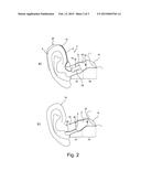 HEARING AID DEVICE AND METHOD FOR FEEDBACK REDUCTION diagram and image