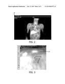 METHOD FOR QUANTIFICATION OF UNCERTAINTY OF CONTOURS IN MANUAL & AUTO     SEGMENTING ALGORITHMS diagram and image