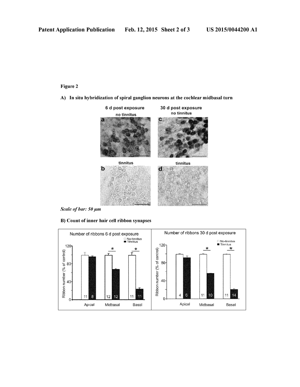 TREATMENT OF TINNITUS THROUGH MODULATION OF CHLORIDE CO-TRANSPORTER NKCC1     IN THE AUDITORY SYSTEM - diagram, schematic, and image 03