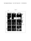 N-DOMAIN OF CARCINOEMBRYONIC ANTIGEN AND COMPOSITIONS, METHODS AND USES     THEREOF diagram and image