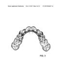 DENTAL POSITIONER diagram and image