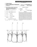 BIOCOMPATIBLE MATERIAL BARS APT TO PREVENT THE INTERDENTAL BONE PEAK     RESORPTION FOLLOWING DENTAL PROCEDURES AND / OR PERIODONTAL DISEASES diagram and image