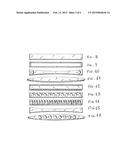 BIOCOMPATIBLE MATERIAL BARS APT TO PREVENT THE INTERDENTAL BONE PEAK     RESORPTION FOLLOWING DENTAL PROCEDURES AND / OR PERIODONTAL DISEASES diagram and image