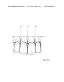 BIOCOMPATIBLE MATERIAL BARS APT TO PREVENT THE INTERDENTAL BONE PEAK     RESORPTION FOLLOWING DENTAL PROCEDURES AND / OR PERIODONTAL DISEASES diagram and image